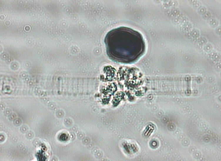 Dictyocha speculum